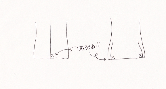 しつけ糸の取り忘れにご用心